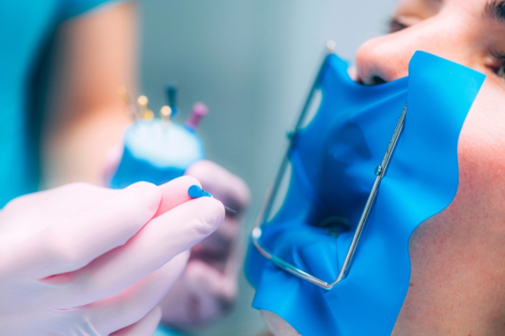 root canals for health and smile